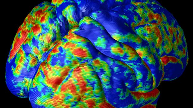 3D snímek lidského mozku získaný magnetickou rezonancí (ilustraèní snímek)