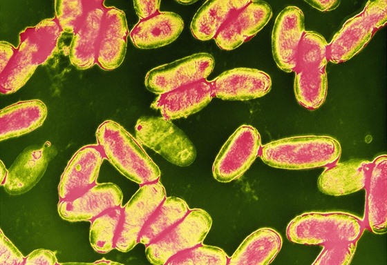 Bakterie Bordetella pertussis, která zpùsobuje vysoce nakažlivý èerný kašel.
