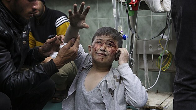Rafáh. Palestinský chlapec zranìný pøi izraelském bombardování (24. bøezna 2024)